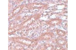 Immunohistochemistry (IHC) image for anti-Ectodermal-Neural Cortex 1 (With BTB-Like Domain) (ENC1) (Middle Region) antibody (ABIN1030924)