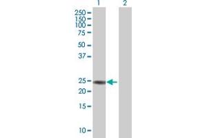 Image no. 1 for anti-RAB26, Member RAS Oncogene Family (RAB26) (AA 1-190) antibody (ABIN525456)
