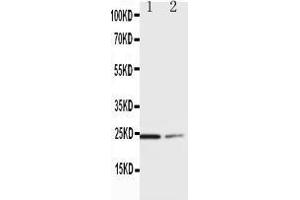 Image no. 2 for anti-Suppressor of Cytokine Signaling 1 (SOCS1) (AA 197-211), (C-Term) antibody (ABIN3044331)