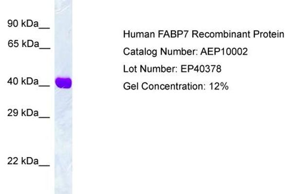 Fatty Acid Binding Protein 7, Brain (FABP7) protein