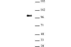 Image no. 3 for anti-CCCTC-Binding Factor (Zinc Finger Protein) (CTCF) (N-Term) antibody (ABIN6971556)