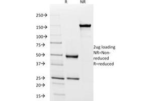 Western Blotting (WB) image for anti-MHC Class II HLA-DP/DQ/DR (HLA-DP/DQ/DR) antibody (ABIN6941388)