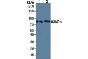 Image no. 4 for Cartilage Oligomeric Matrix Protein (COMP) ELISA Kit (ABIN6720567)