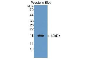 Image no. 1 for anti-Interleukin 6 Receptor (IL6R) (AA 52-204) antibody (ABIN1859439)