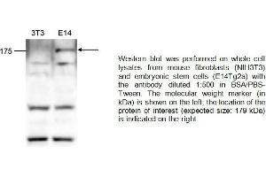 Image no. 2 for anti-Lysine (K)-Specific Demethylase 5B (KDM5B) (Center) antibody (ABIN2487009)
