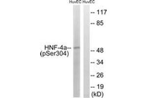 Image no. 1 for anti-Hepatocyte Nuclear Factor 4, alpha (HNF4A) (AA 280-329), (pSer313) antibody (ABIN1531864)
