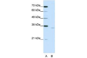 Image no. 1 for anti-Cytoplasmic Polyadenylation Element Binding Protein 2 (CPEB2) (Middle Region) antibody (ABIN629930)