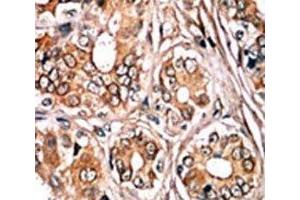 Image no. 2 for anti-Retinoblastoma Protein (Rb Protein) (pSer780) antibody (ABIN3032466)