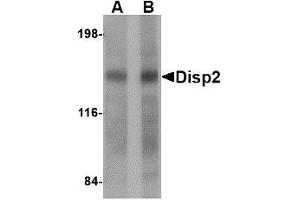 Image no. 1 for anti-Dispatched Homolog 2 (DISP2) (C-Term) antibody (ABIN499750)