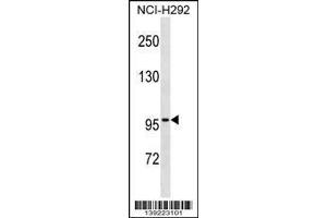 Image no. 1 for anti-Zinc Finger Protein 229 (ZNF229) (AA 60-89), (N-Term) antibody (ABIN1539503)