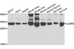 Image no. 1 for anti-Interleukin 20 Receptor beta (IL20RB) antibody (ABIN6571498)