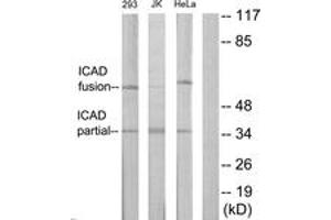 Image no. 1 for anti-DNA Fragmentation Factor, 45kDa, alpha Polypeptide (DFFA) (AA 151-200) antibody (ABIN1534436)