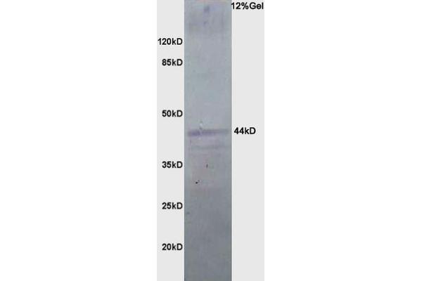 anti-Prenyl (Decaprenyl) Diphosphate Synthase, Subunit 2 (PDSS2) (AA 21-100) antibody
