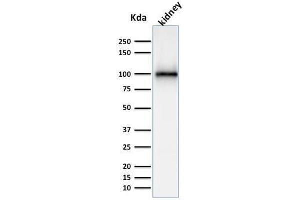 anti-Membrane Metallo-Endopeptidase (MME) (AA 297-483) antibody