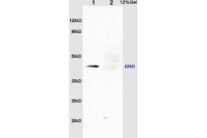 L1 rat liver lysates L2 rat kidney lysates probed with Rabbit Anti-ERK1 (Thr203/Tyr205) + ERK2 (Thr183/Tyr185) Polyclonal Antibody, Unconjugated (ABIN687727) at 1:200 overnight at 4 °C.