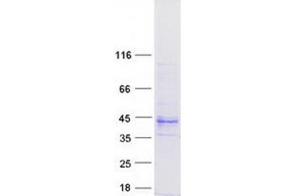 TMEM231 Protein (Transcript Variant 3) (Myc-DYKDDDDK Tag)