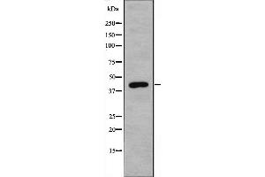 Image no. 2 for anti-Galactokinase 1 (GALK1) (C-Term) antibody (ABIN6257234)