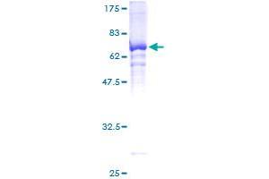 Image no. 1 for Histone Deacetylase 11 (HDAC11) (AA 1-347) protein (GST tag) (ABIN1306446)
