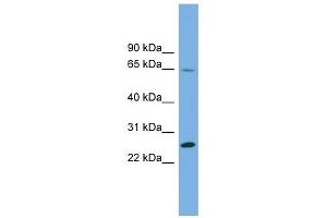 Image no. 1 for anti-Dihydrofolate Reductase-Like 1 (DHFRL1) (Middle Region) antibody (ABIN632654)