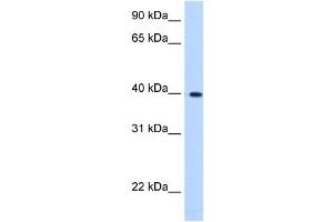 Image no. 1 for anti-Lipoic Acid Synthetase (LIAS) (C-Term) antibody (ABIN630828)