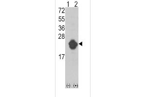 anti-Interleukin 1 Receptor Antagonist (IL1RN) antibody