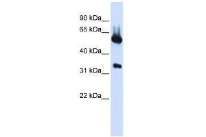 Image no. 1 for anti-Aminolevulinate, delta-, Synthase 2 (ALAS2) (N-Term) antibody (ABIN631054)