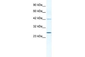 anti-Gap Junction Protein, beta 4, 30.3kDa (GJB4) (Middle Region) antibody