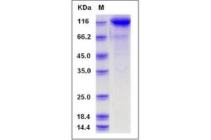 Image no. 1 for CUB Domain Containing Protein 1 (CDCP1) (AA 1-666) protein (Fc Tag) (ABIN2008627)