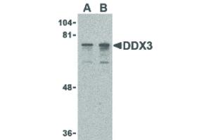 Image no. 1 for anti-DEAD (Asp-Glu-Ala-Asp) Box Polypeptide 3, X-Linked (DDX3X) (N-Term) antibody (ABIN6655854)