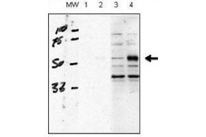 Image no. 7 for anti-Activin A Receptor Type II-Like 1 (ACVRL1) (AA 38-68) antibody (ABIN3029853)