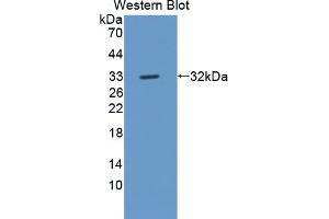 Image no. 2 for anti-C-Ros Oncogene 1 , Receptor tyrosine Kinase (ROS1) (AA 1937-2210) antibody (ABIN1870413)