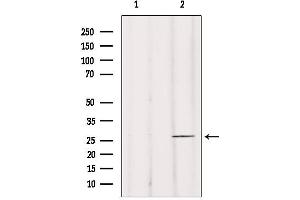 Image no. 1 for anti-Breast Cancer Metastasis Suppressor 1 (BRMS1) (N-Term) antibody (ABIN6256973)