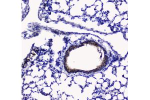 Image no. 4 for anti-Betacellulin (BTC) (AA 32-177) antibody (ABIN5692803)