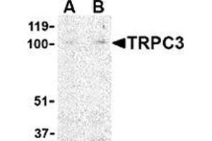 Image no. 2 for anti-Transient Receptor Potential Cation Channel, Subfamily C, Member 3 (TRPC3) (N-Term) antibody (ABIN501060)