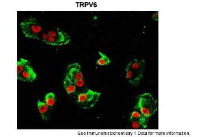 Image no. 2 for anti-Transient Receptor Potential Cation Channel, Subfamily V, Member 6 (TRPV6) (Middle Region) antibody (ABIN2776225)