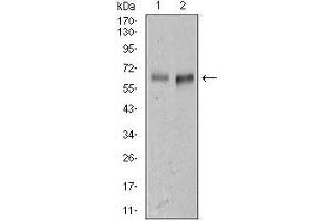 Image no. 4 for anti-Activated Leukocyte Cell Adhesion Molecule (ALCAM) (AA 405-524) antibody (ABIN1098107)