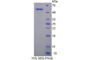Image no. 1 for Kallikrein 14 (KLK14) (AA 36-267) protein (His tag,GST tag) (ABIN6236982)