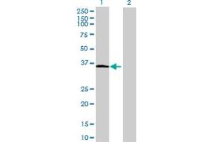 Western Blot analysis of ABTB1 expression in transfected 293T cell line by ABTB1 MaxPab polyclonal antibody.