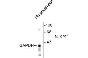 Image no. 1 for anti-Glyceraldehyde-3-Phosphate Dehydrogenase, Spermatogenic (GAPDHS) antibody (ABIN361377)
