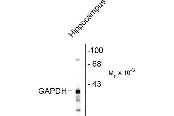 anti-Glyceraldehyde-3-Phosphate Dehydrogenase, Spermatogenic (GAPDHS) antibody