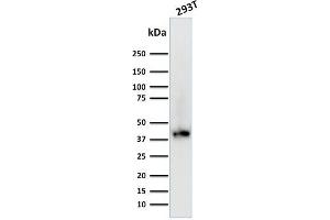 Image no. 1 for anti-BMI1 Polycomb Ring Finger Oncogene (BMI1) (AA 142-326) antibody (ABIN6940580)