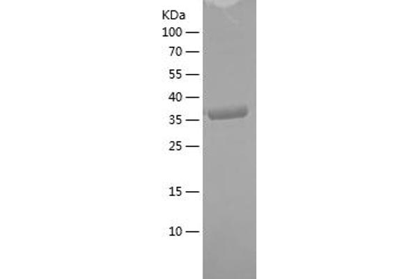 Beclin 1 Protein (AA 46-152) (His-IF2DI Tag)
