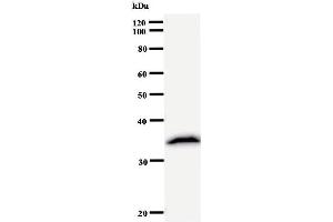 Image no. 2 for anti-Ribonuclease P/MRP 30kDa Subunit (RPP30) antibody (ABIN933123)