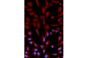 Image no. 3 for anti-WNT Inhibitory Factor 1 (WIF1) antibody (ABIN1876574)