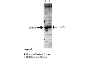 Image no. 1 for anti-Arginine Decarboxylase (ADC) (Middle Region) antibody (ABIN2774017)