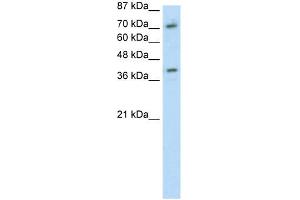 Image no. 2 for anti-Zinc Finger Protein 282 (ZNF282) (C-Term) antibody (ABIN2780535)