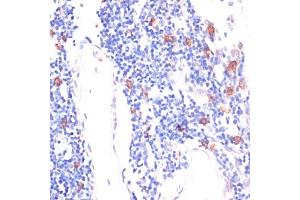 WNT5B antibody  (AA 120-359)