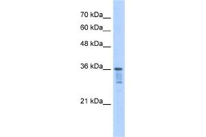 Image no. 1 for anti-Leucine Zipper Transcription Factor-Like 1 (LZTFL1) (C-Term) antibody (ABIN2783348)