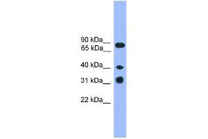 LAX1 antibody  (C-Term)