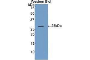 Image no. 2 for Lipopolysaccharide Binding Protein (LBP) ELISA Kit (ABIN6720569)